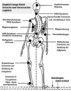 Methode Dorn.6